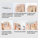 Kit Completo Para Desencravar Unhas